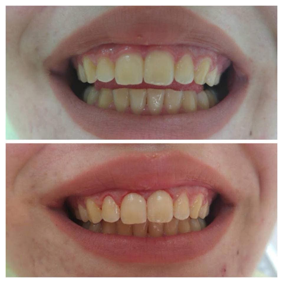 Dental Choice — ortodontska terapija