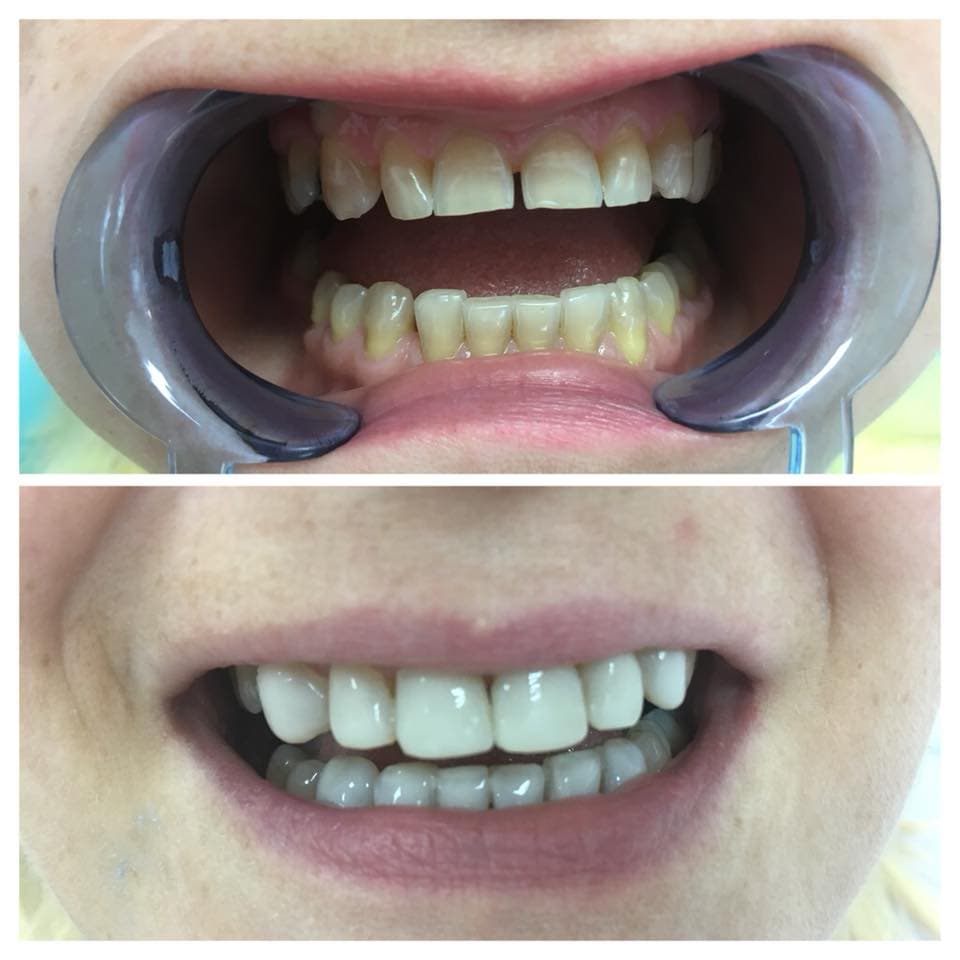 Dental Choice — estetski radovi
