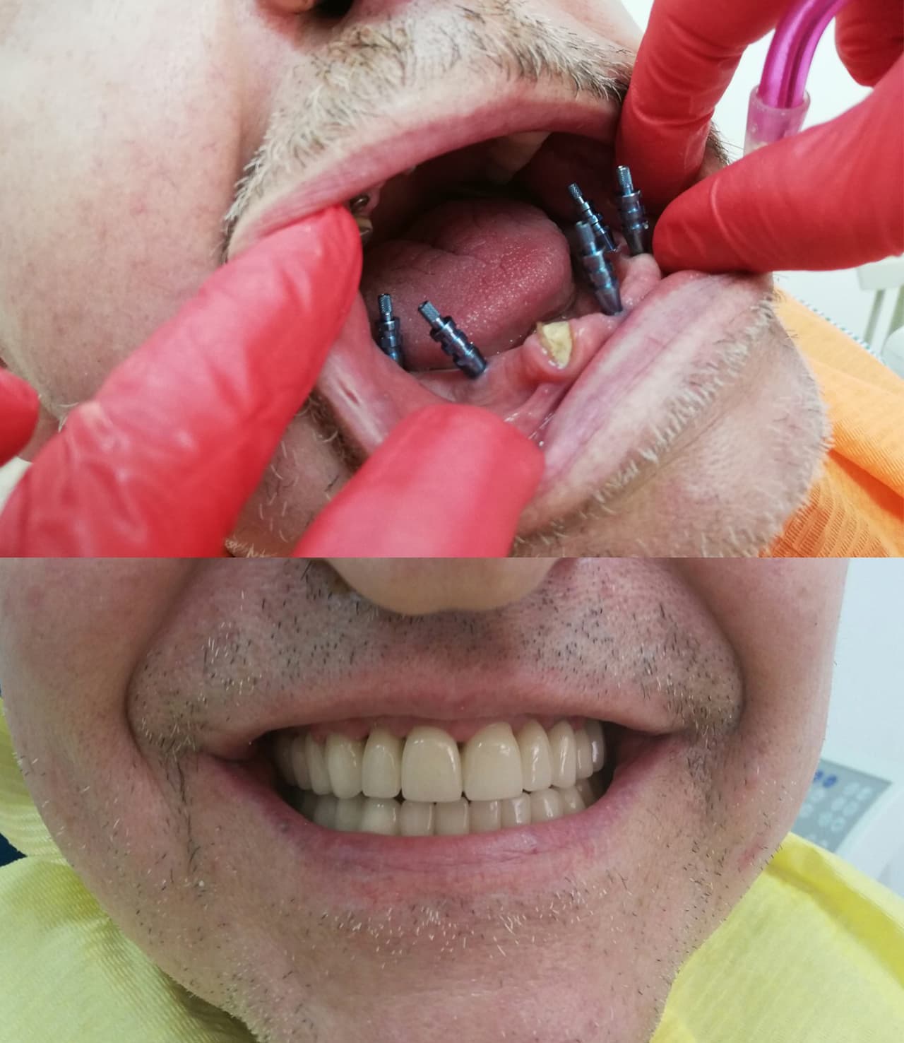 Dental Choice — protetski radovi