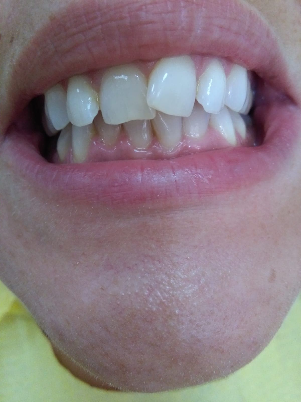 Dental Choice — zubni implanti