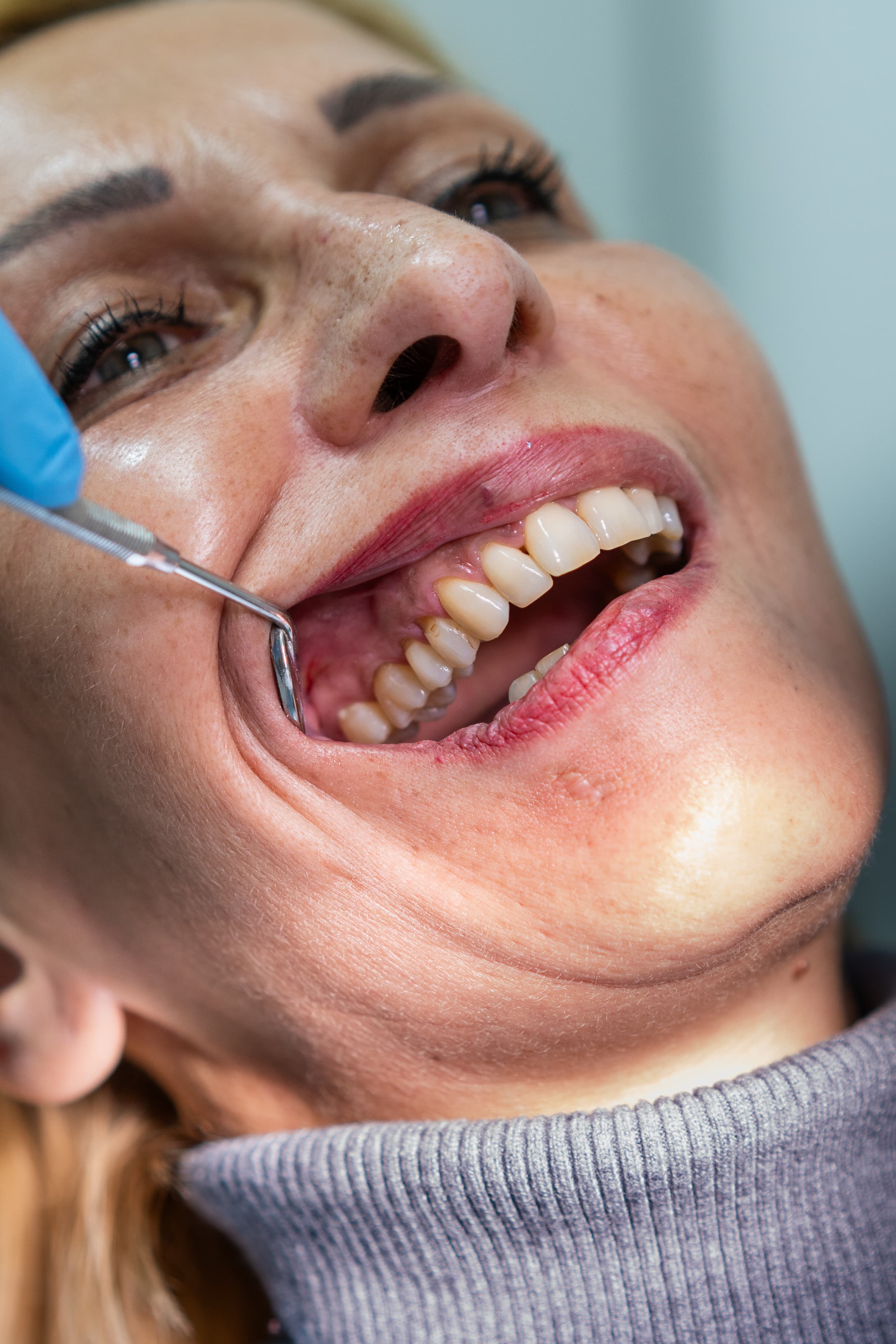 Dental Choice — prikaz stomatološkog rada 1