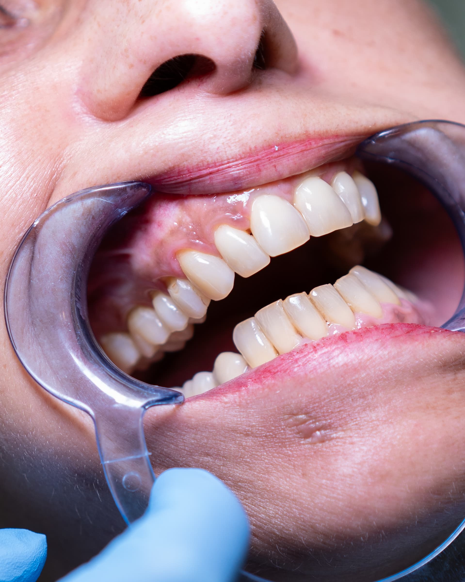 Dental Choice — prikaz stomatološkog rada 4