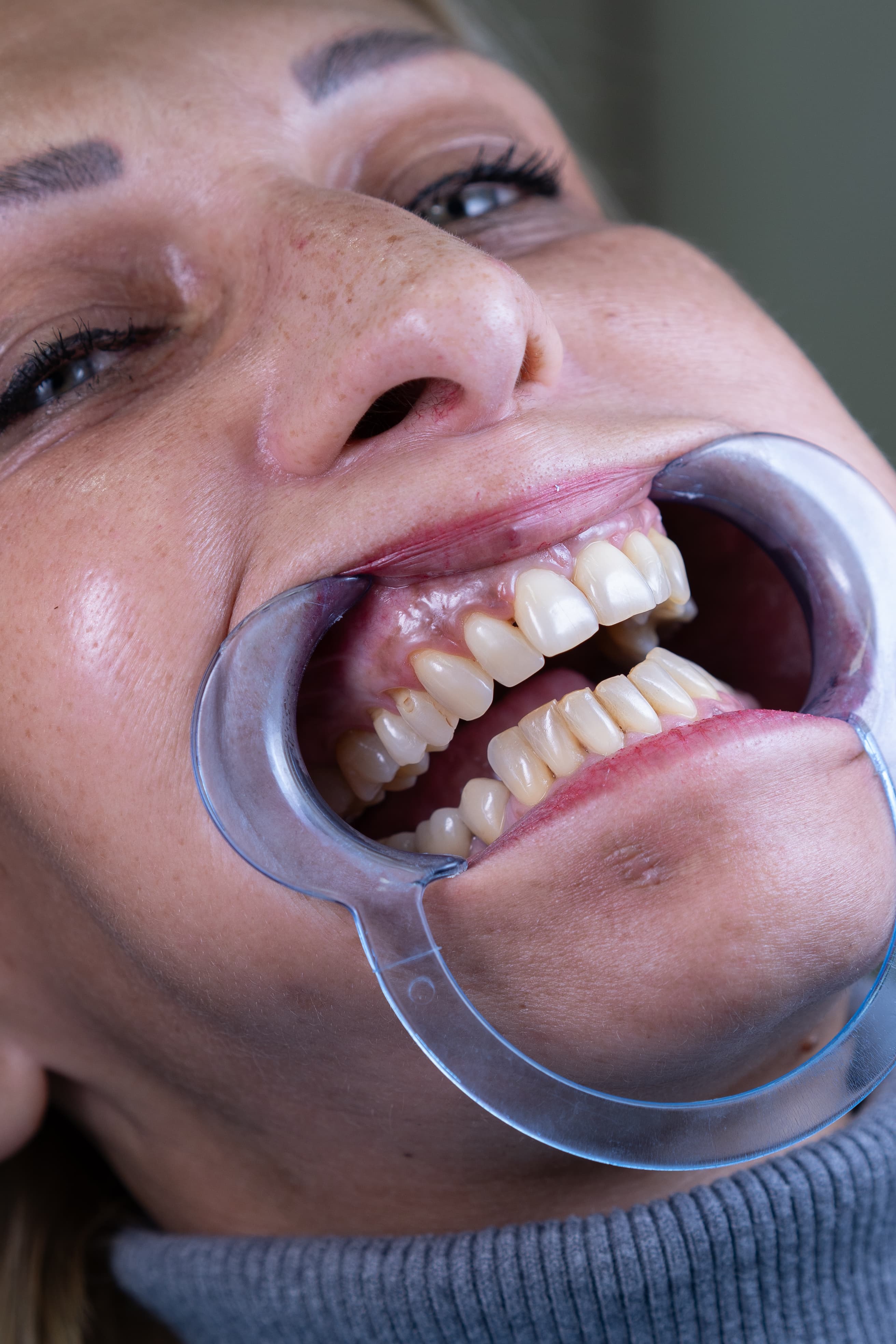 Dental Choice — prikaz stomatološkog rada 5