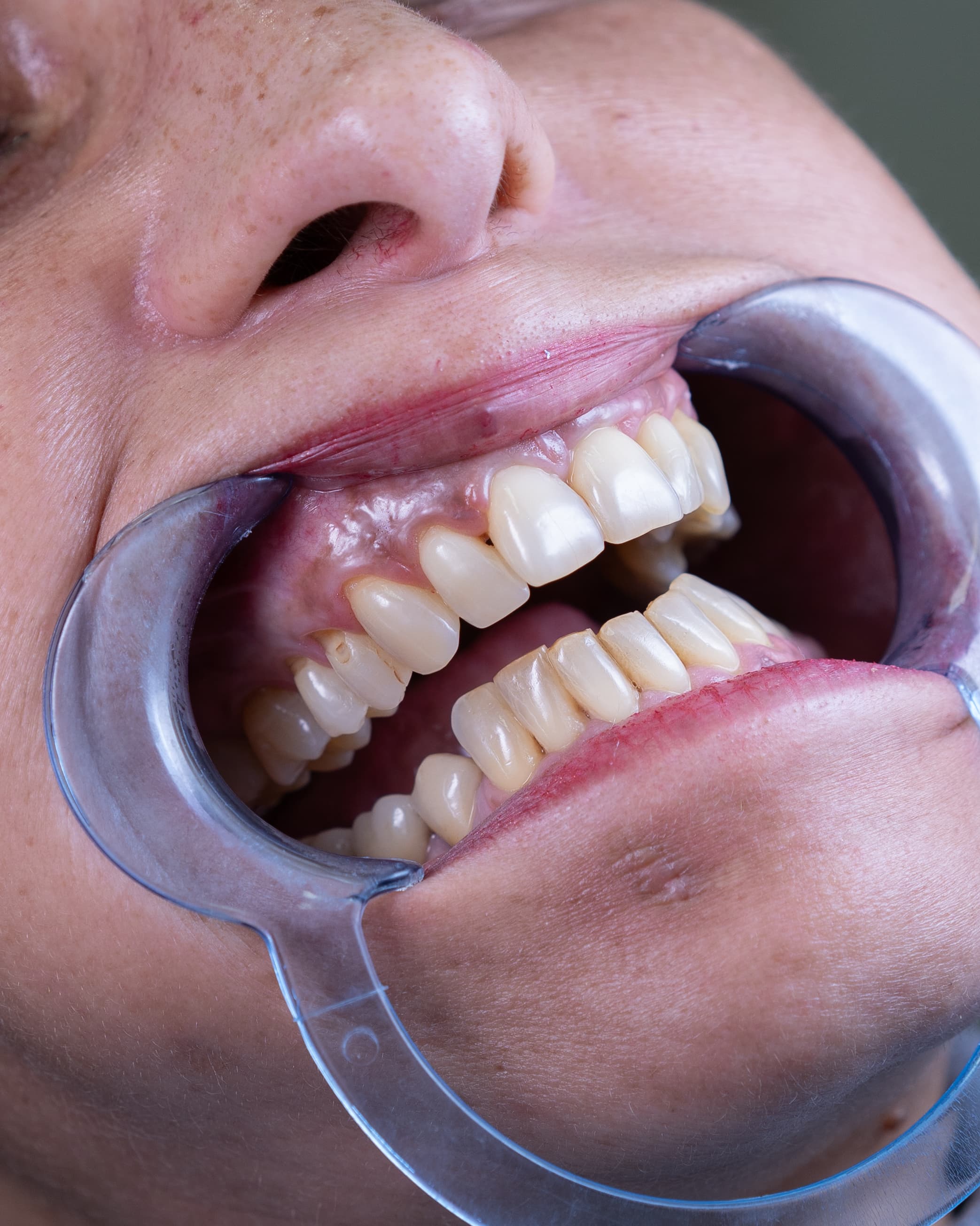 Dental Choice — prikaz stomatološkog rada 6