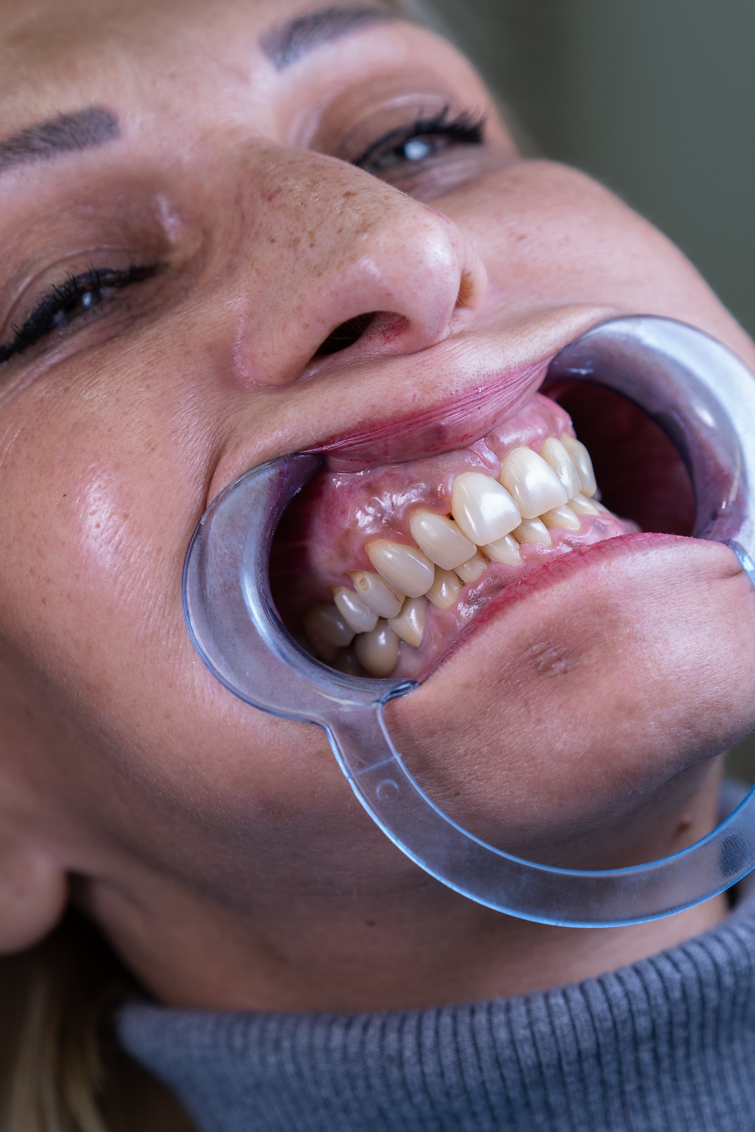 Dental Choice — prikaz stomatološkog rada 7