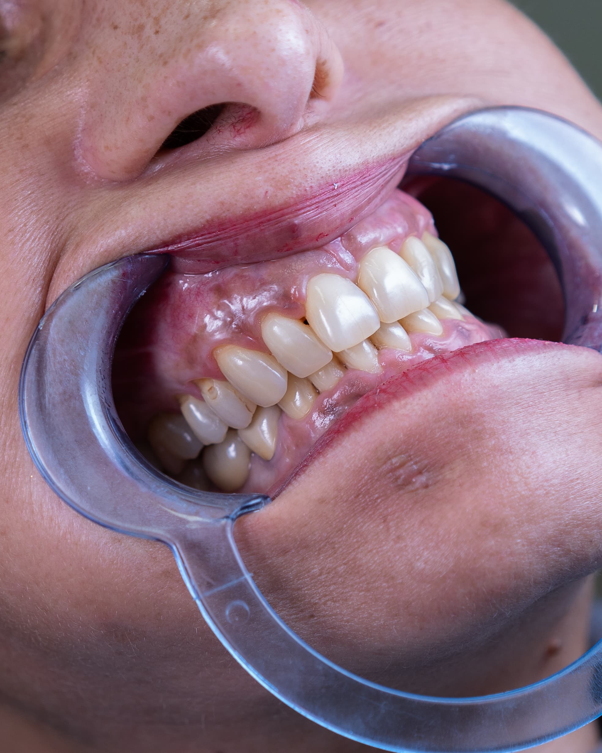 Dental Choice — prikaz stomatološkog rada 8