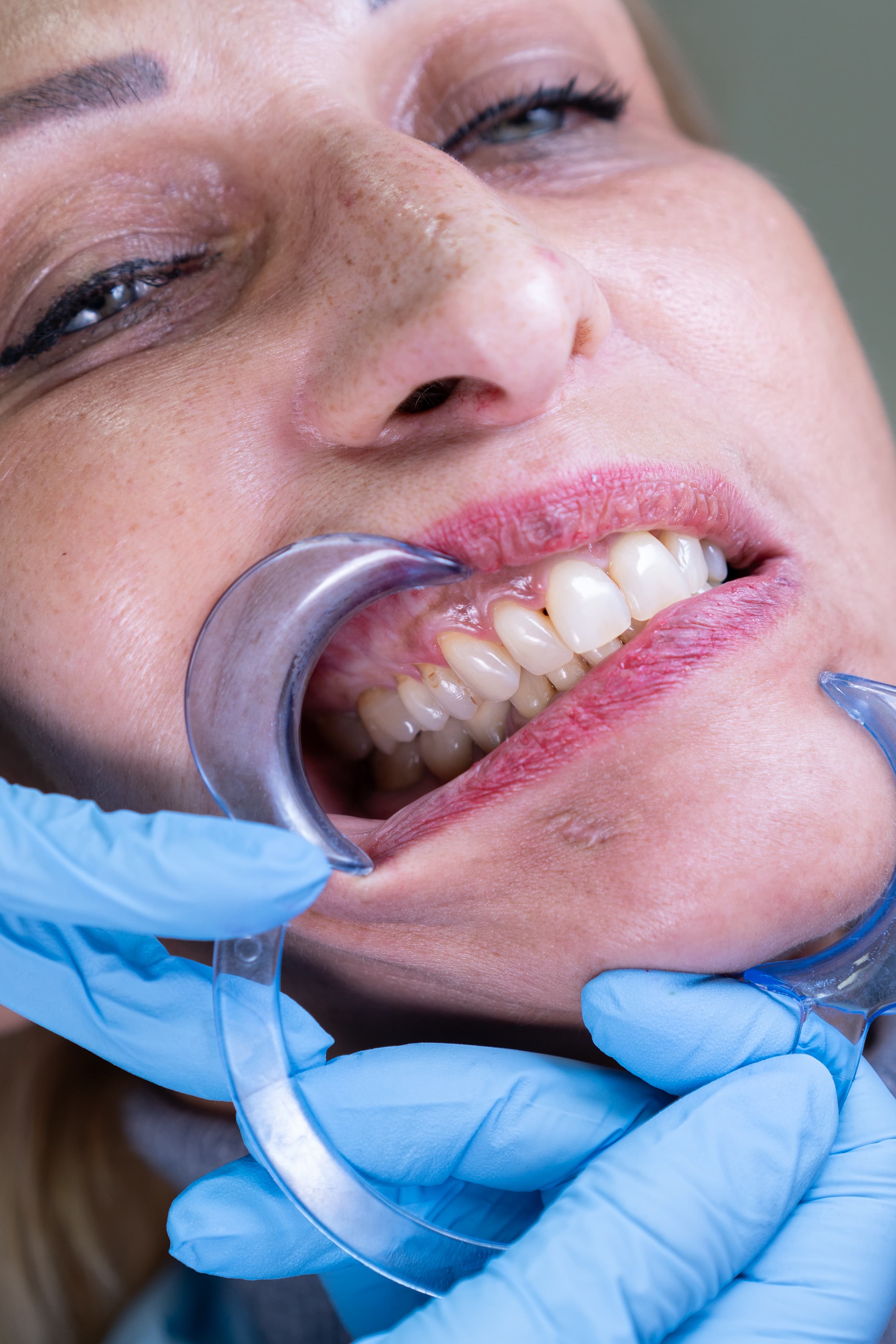 Dental Choice — prikaz stomatološkog rada 9
