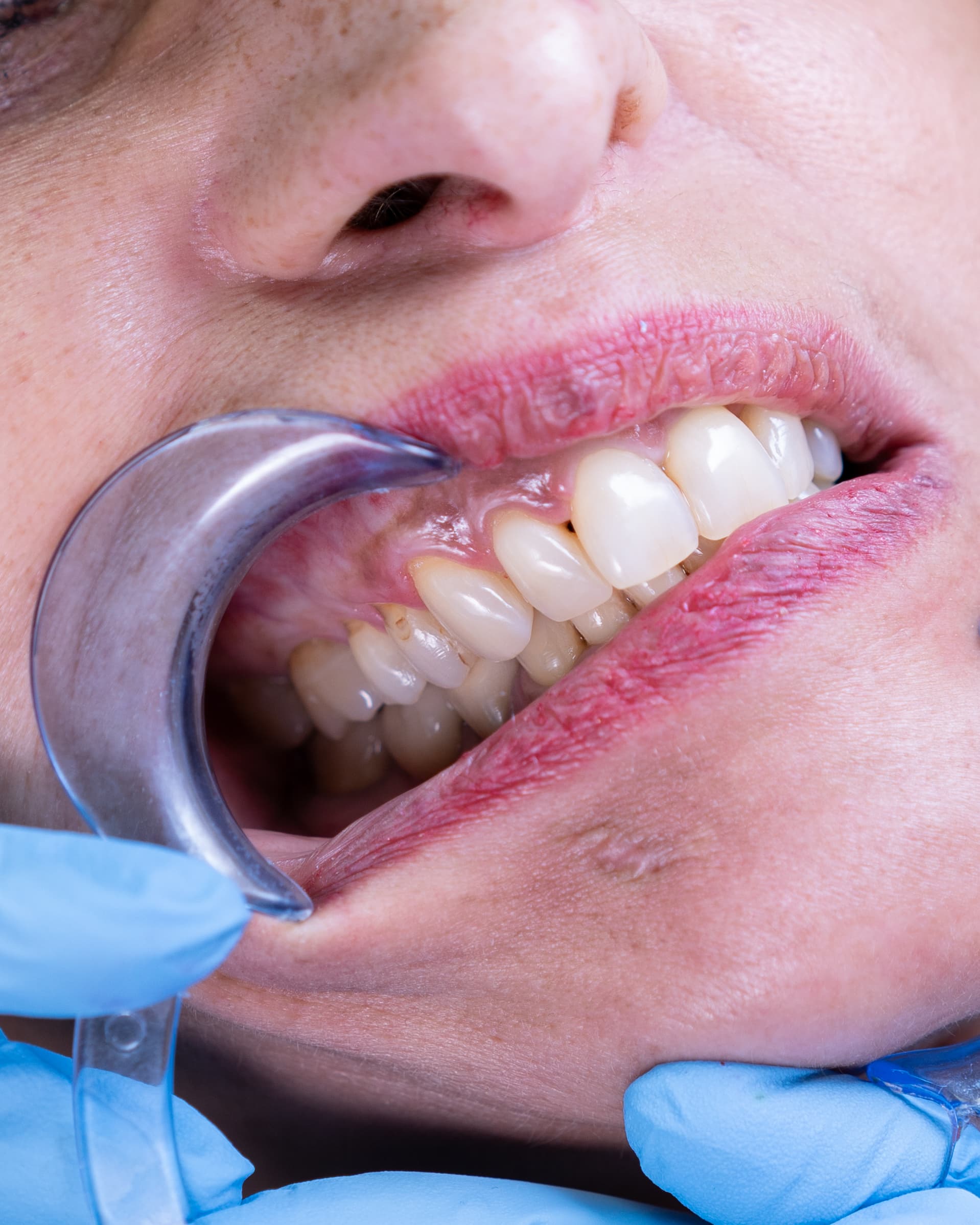 Dental Choice — prikaz stomatološkog rada 10