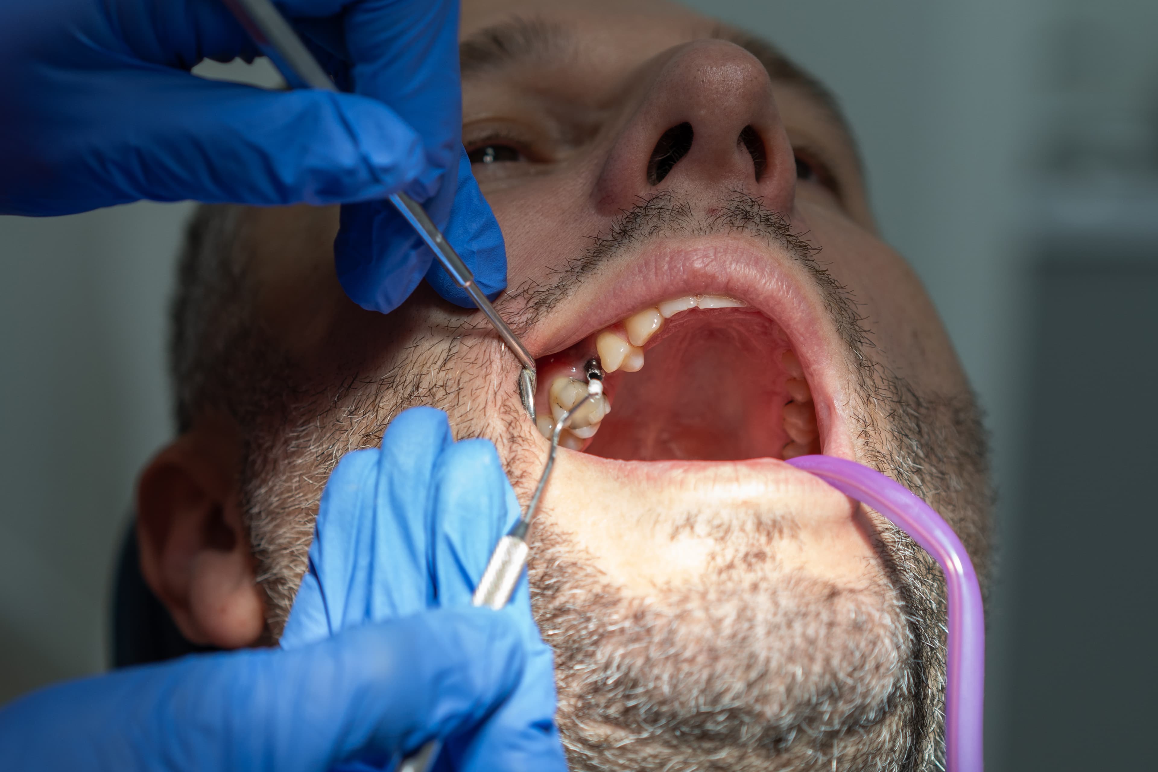 Dental Choice — prikaz stomatološkog rada 12