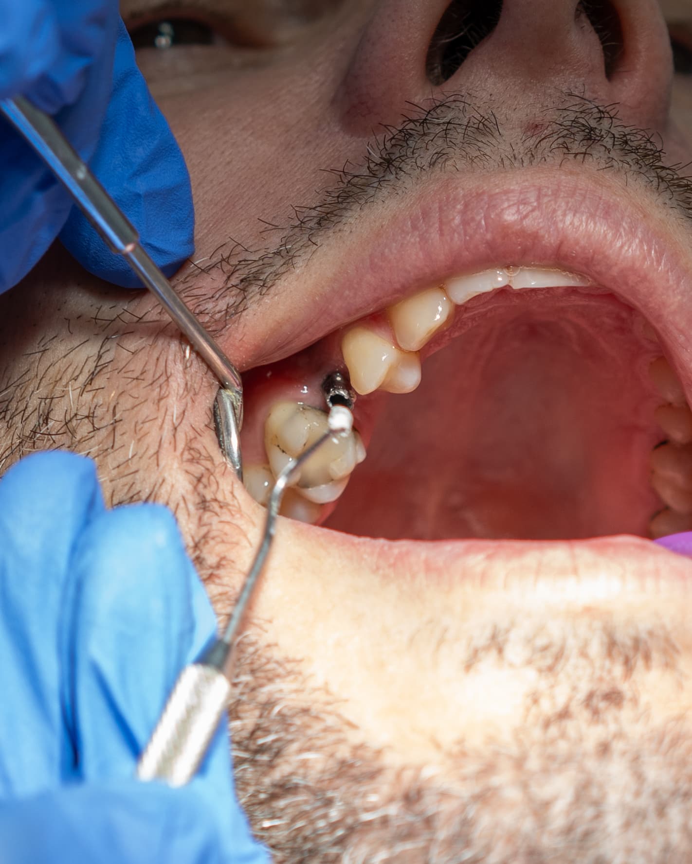 Dental Choice — prikaz stomatološkog rada 13