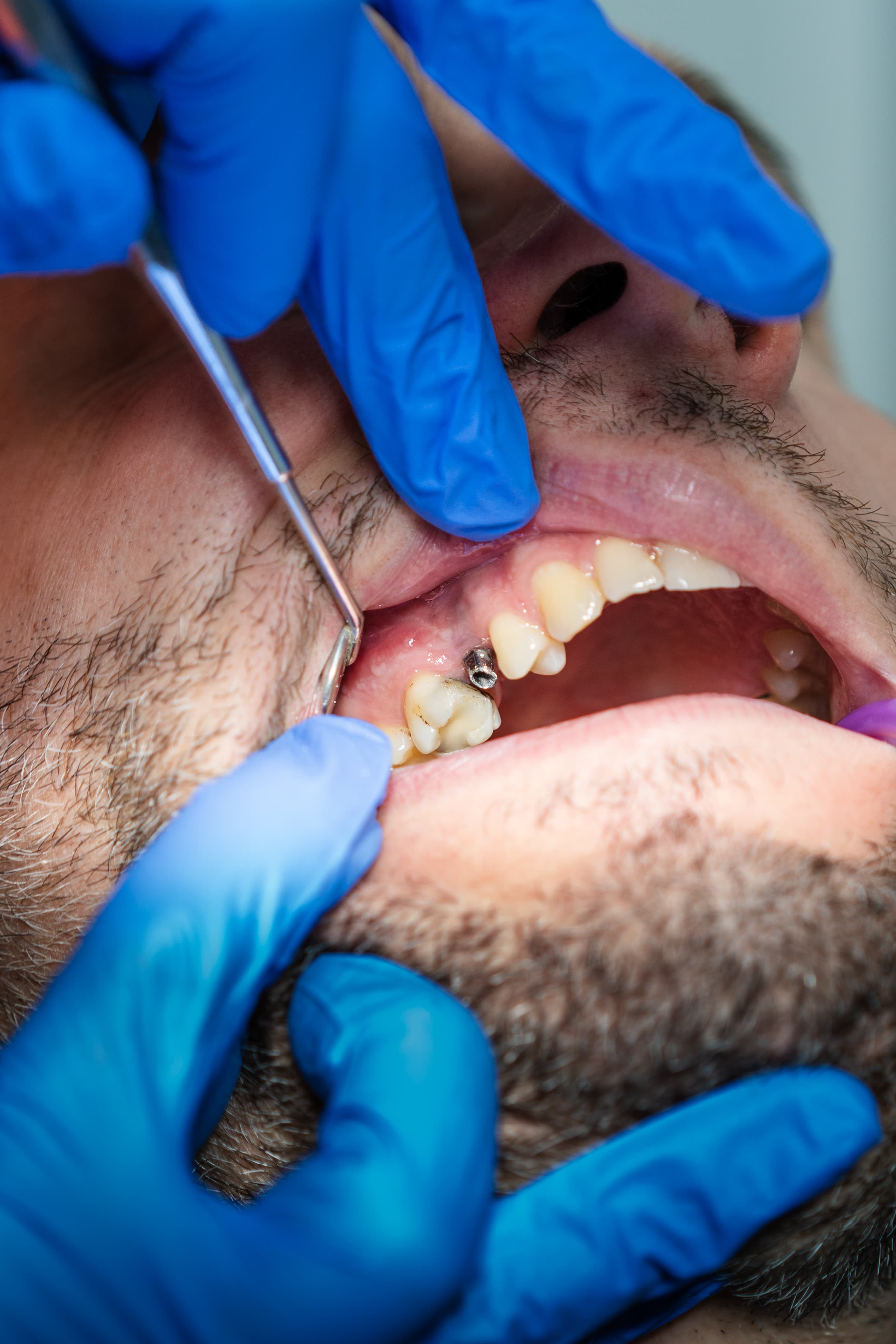 Dental Choice — prikaz stomatološkog rada 14