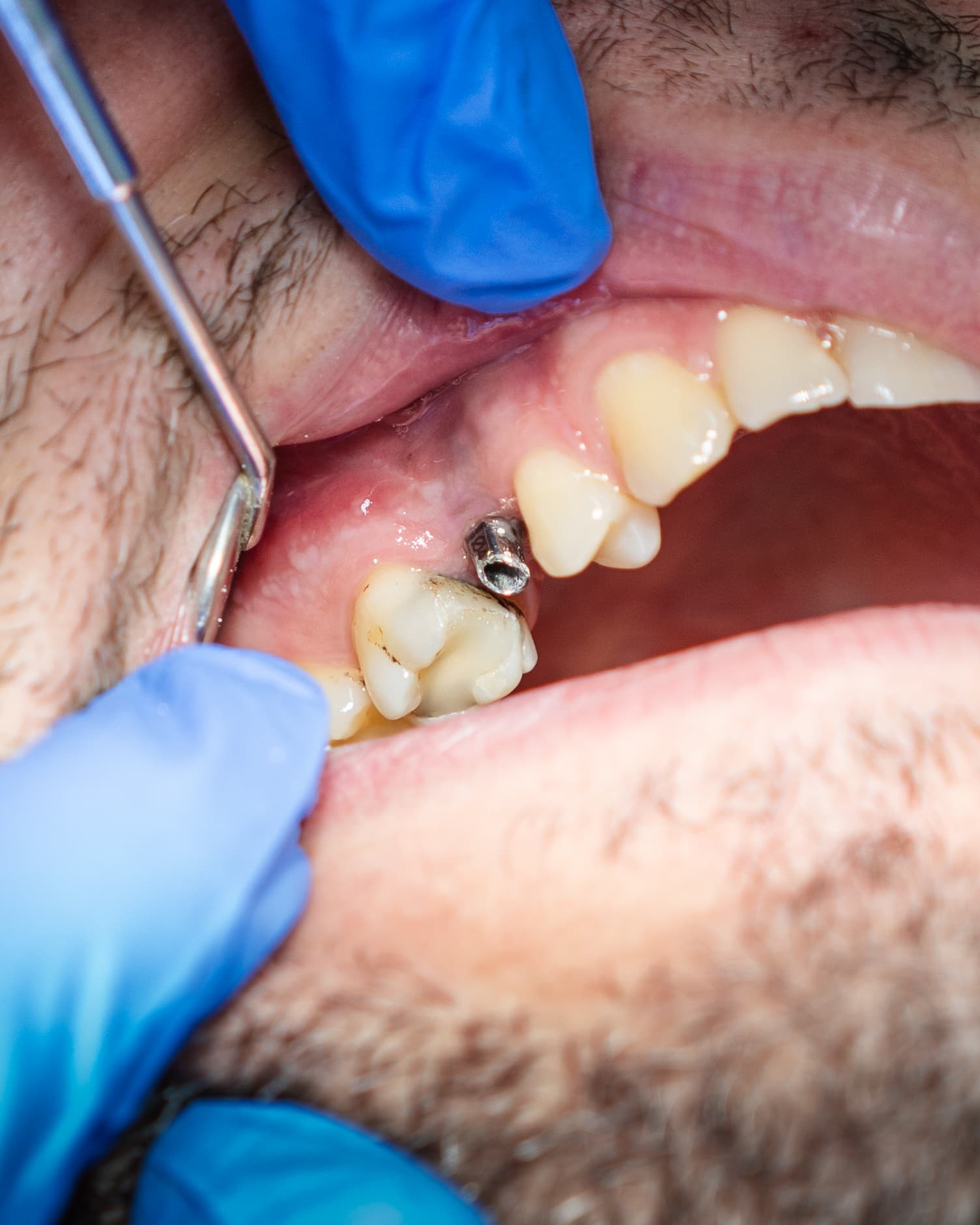 Dental Choice — prikaz stomatološkog rada 15