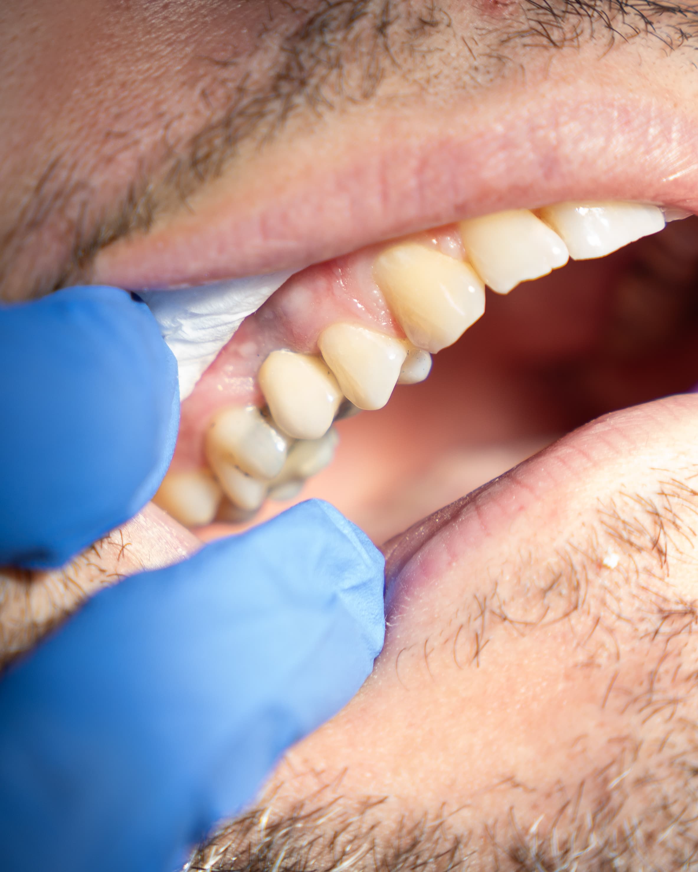 Dental Choice — prikaz stomatološkog rada 17