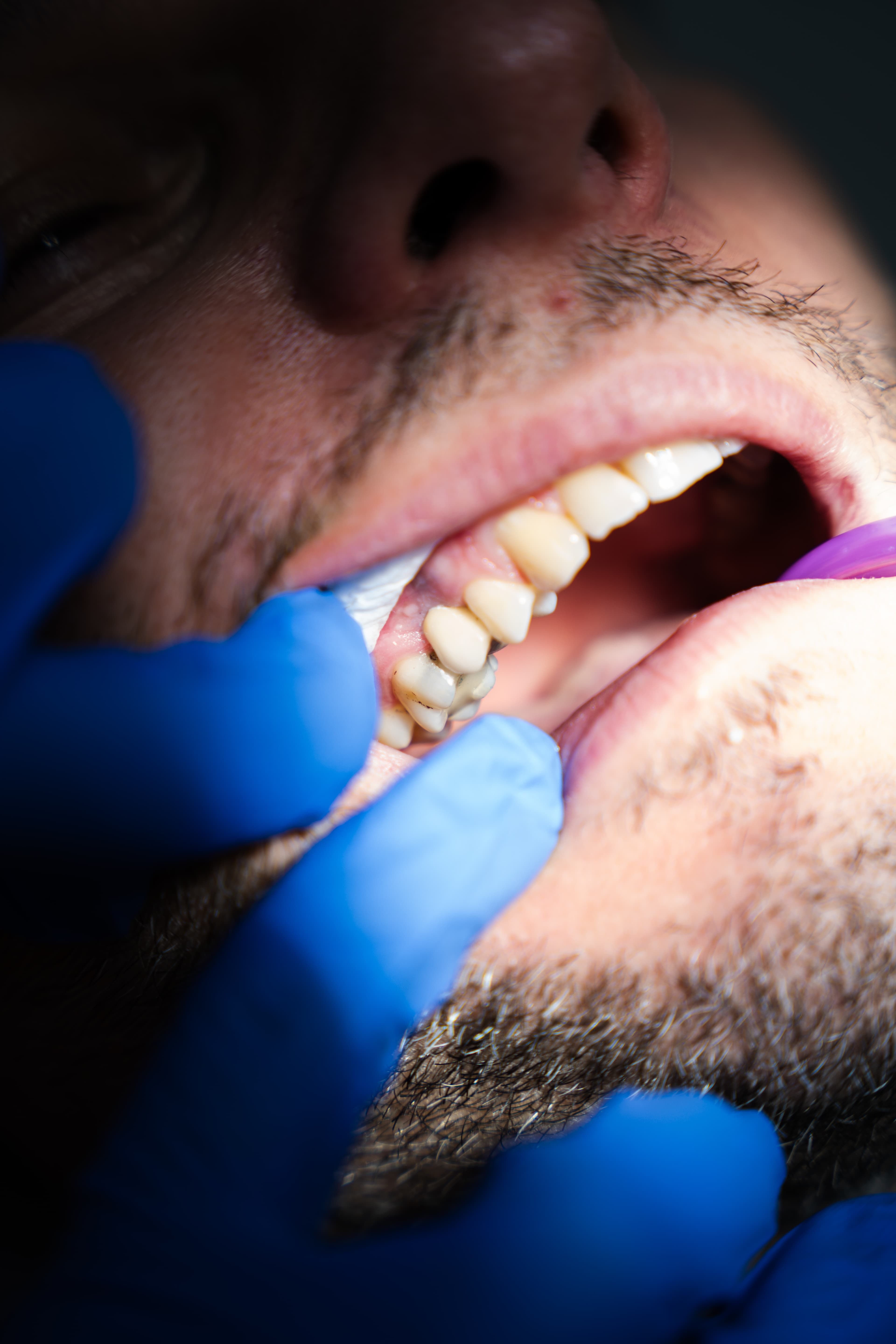 Dental Choice — prikaz stomatološkog rada 18