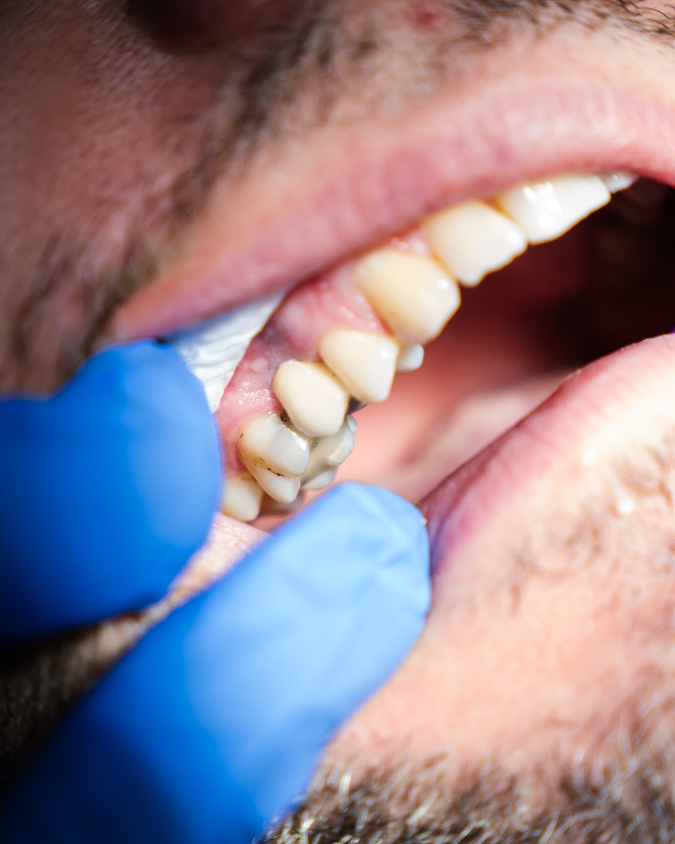 Dental Choice — prikaz stomatološkog rada 19
